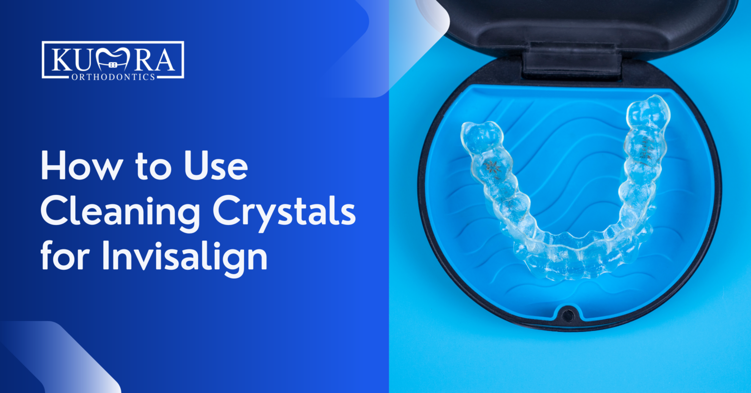 Step By Step Guide For Using Invisalign Cleaning Crystals Kumra