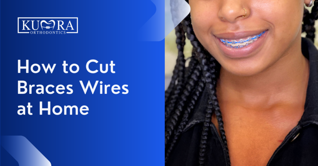 How to Cut Pokey Braces Wire at Home (Video) Kumra Orthodontics