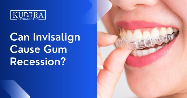 Can Invisalign Cause Gum Recession?