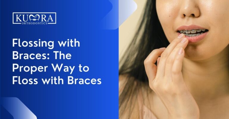 Flossing with Braces: The Proper Way to Floss with Braces