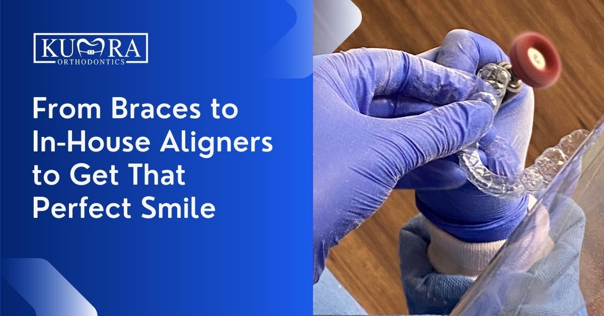 From Braces to In-House Aligners to Get That Perfect Smile