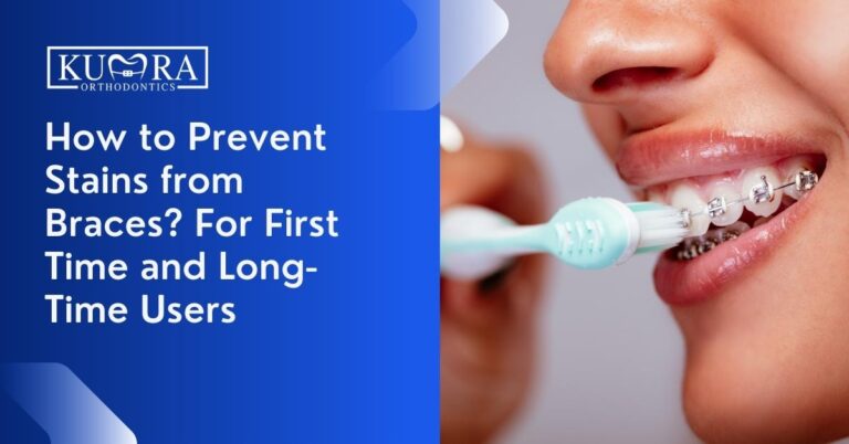 How to Prevent Stains from Braces? For First Time and Long-Time Users