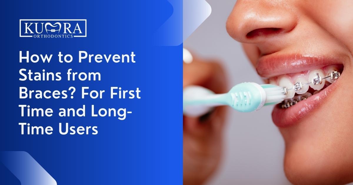 How to Prevent Stains from Braces? For First Time and LongTime Users
