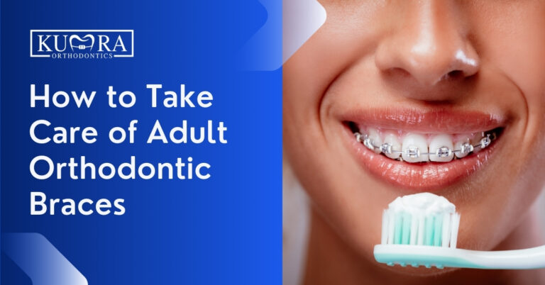 How to Take Care of Your Adult Orthodontic Braces?