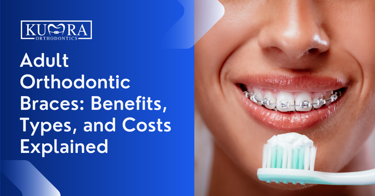 Adult Orthodontic Braces: Benefits, Types, and Costs Explained