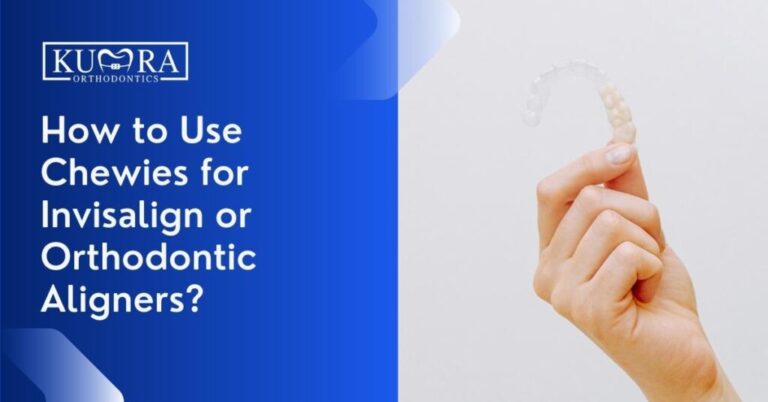How to Use Chewies for Invisalign or Orthodontic Aligners?