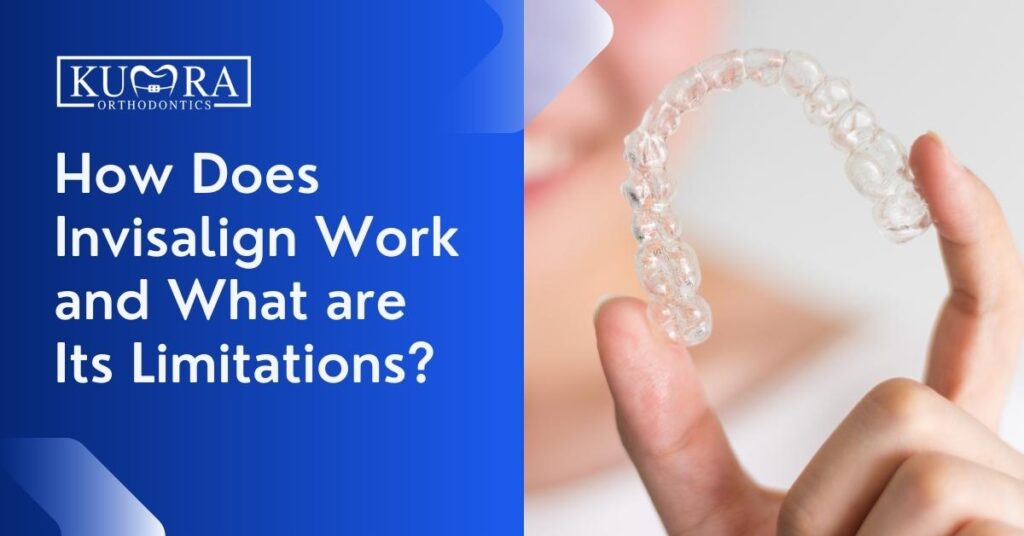 How Does Invisalign Work And What Are Its Limitations? | Kumra Orthodontics