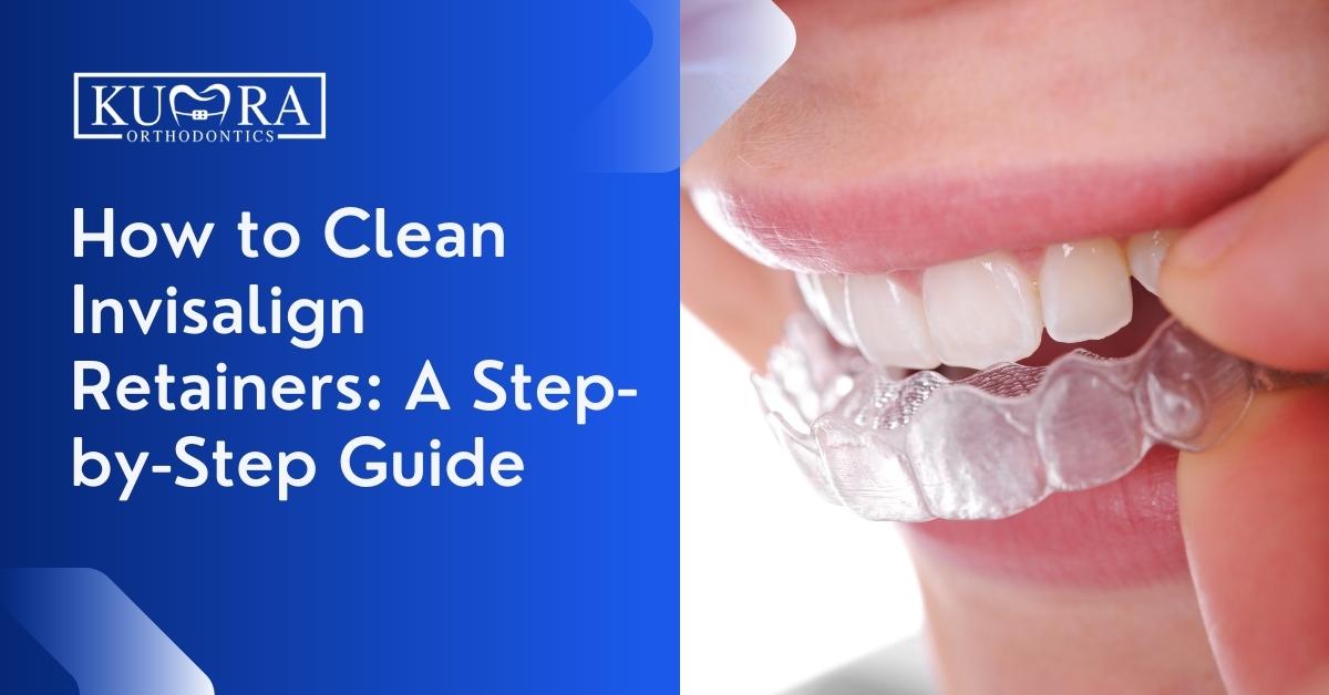How To Clean Vivera Retainers  