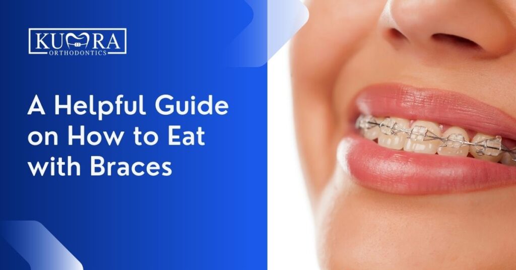 A Helpful Guide on How to Eat with Braces | Kumra Ortho