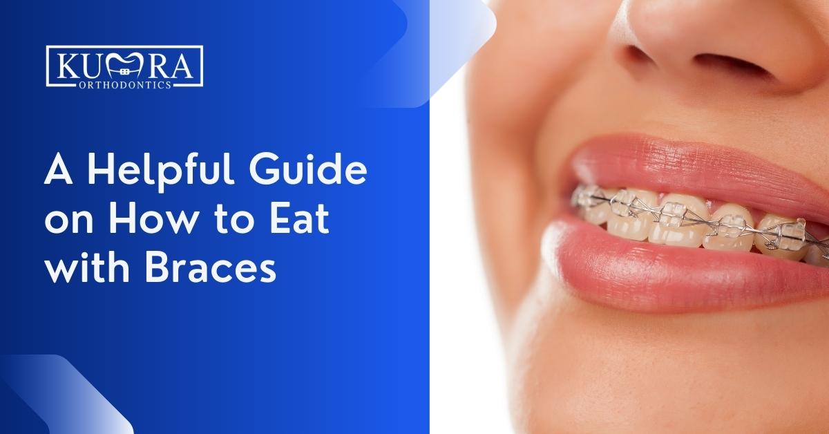 A-Helpful-Guide-on-How-to-Eat-with-Braces