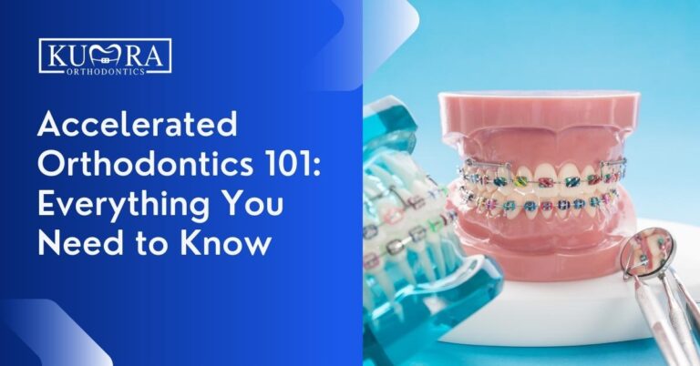 Accelerated Orthodontics 101: Everything You Need to Know