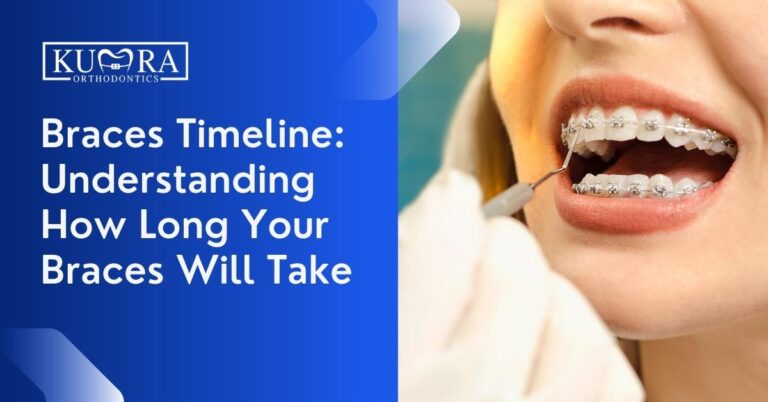 Braces Timeline: Understanding How Long Your Braces Will Take