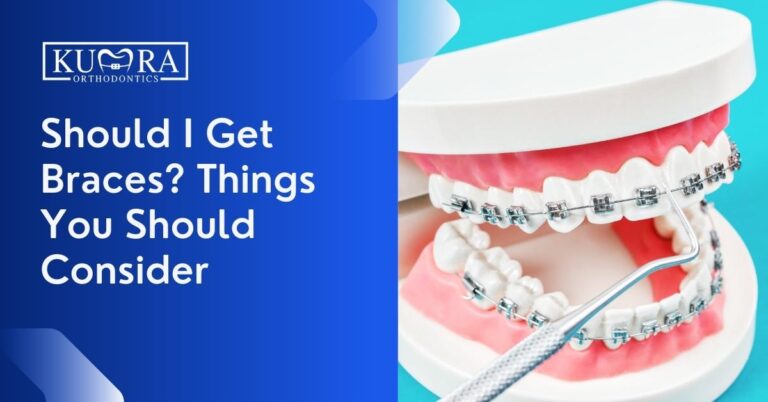 Should I Get Braces? Things You Should Consider
