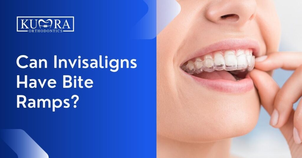 Can Invisaligns Have Bite Ramps? | Kumra Orthodontics