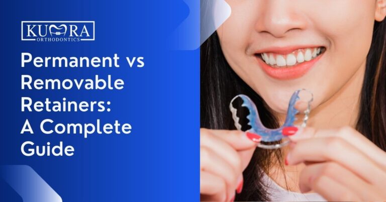 Permanent vs Removable Retainers: A Complete Guide