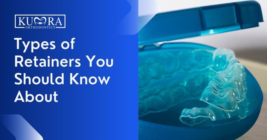 Types of Retainers You Should Know About | Kumra Orthodontics