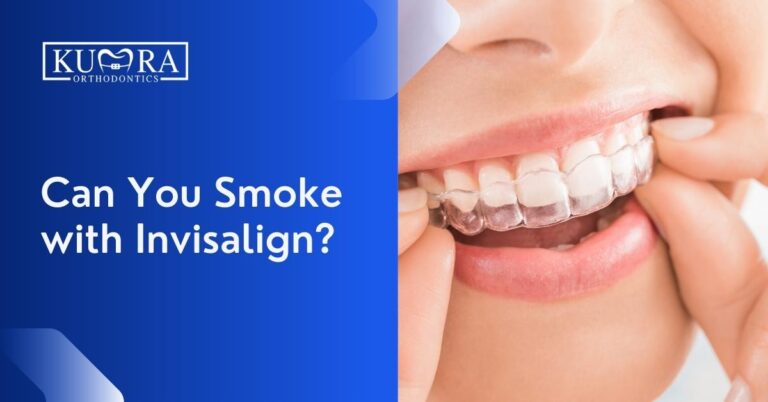 Can You Smoke with Invisalign?