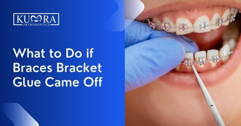 What to Do if Braces Bracket Glue Came Off