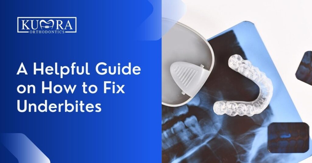 A Helpful Guide on How to Fix Underbites Kumra Orthodontics