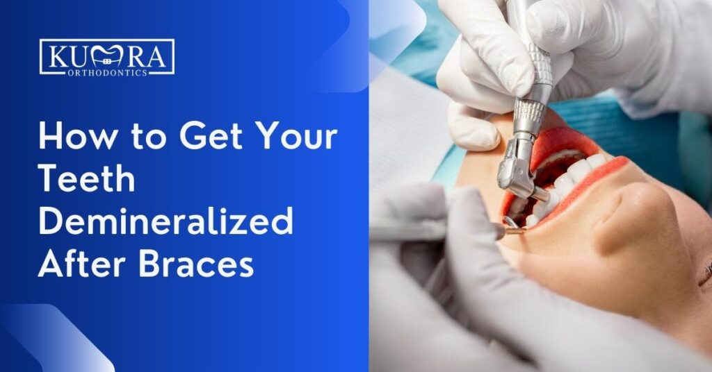 How to Get Your Teeth Demineralized After Braces