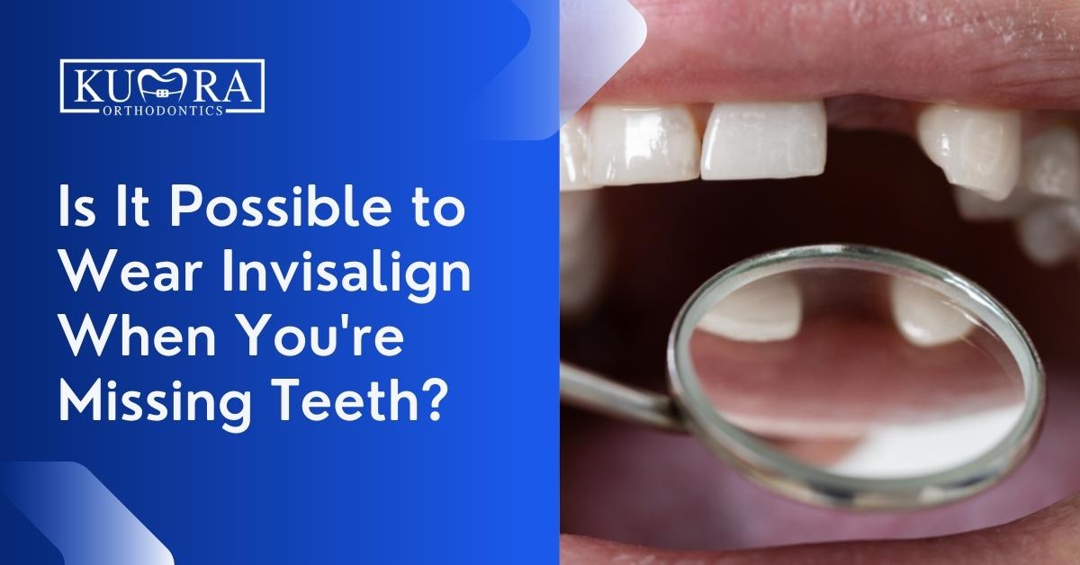 Is-It-Possible-to-Wear-Invisalign-When-Youre-Missing-Teeth_