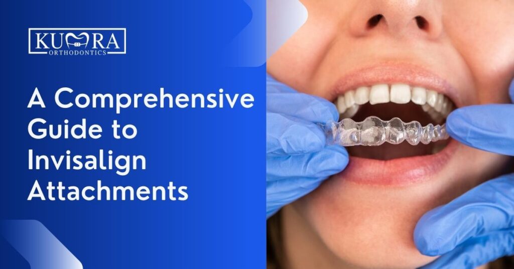 Orthodontic Associates - WHY DOES INVISALIGN TREATMENT USE ATTACHMENTS?   Attachments are tooth-colored ridges that we place on specific teeth to  help teeth move more effectively. They put force in the right