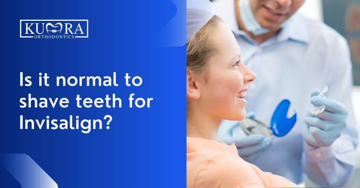 Is-it-normal-to-shave-teeth-for-Invisalign_