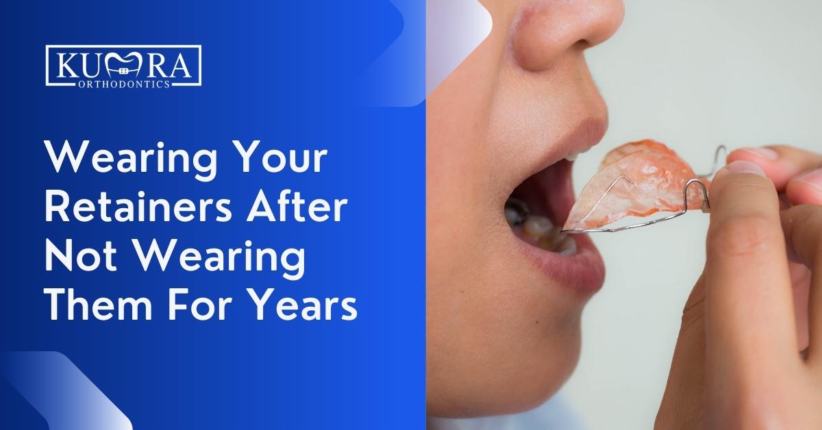 https://kumraortho.com/wp-content/uploads/2022/07/Wearing-Your-Retainers-After-Not-Wearing-Them-For-Years.jpg