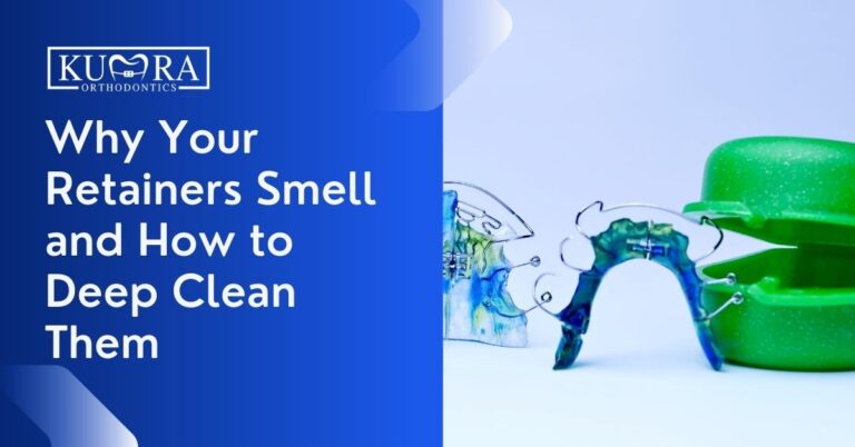 Why Your Retainers Smell and How to Deep Clean Them