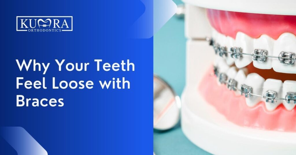 Why Your Teeth Feel Loose with Braces | Kumra Orthodontics