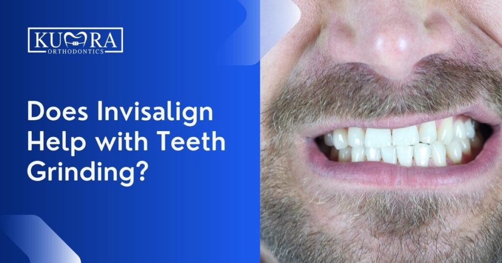 Does Invisalign Help with Teeth Grinding