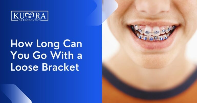 How Long Can You Go With A Loose Bracket?