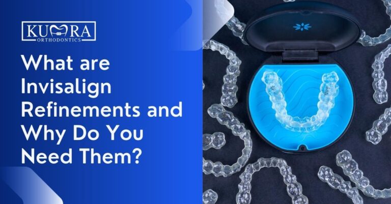 What are Invisalign Refinements and Why Do You Need Them?