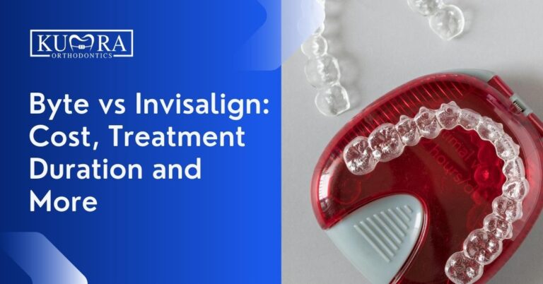 Byte vs Invisalign: Cost, Treatment Duration and More