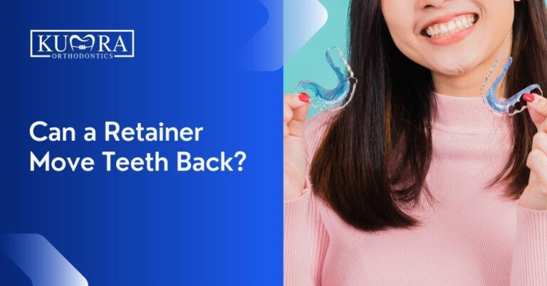 Can a Retainer Move Teeth Back?