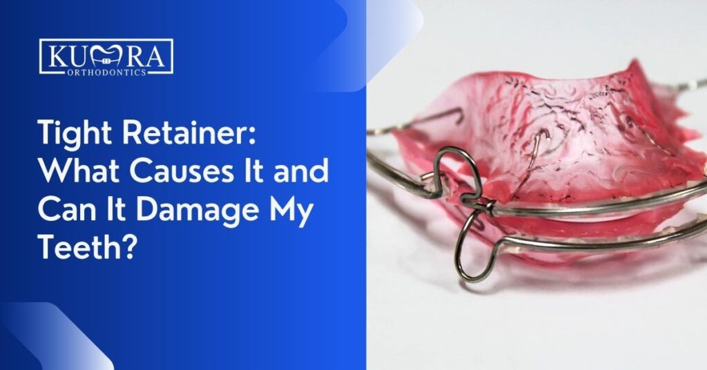 Tight Retainer: What Causes It and Can It Damage My Teeth?