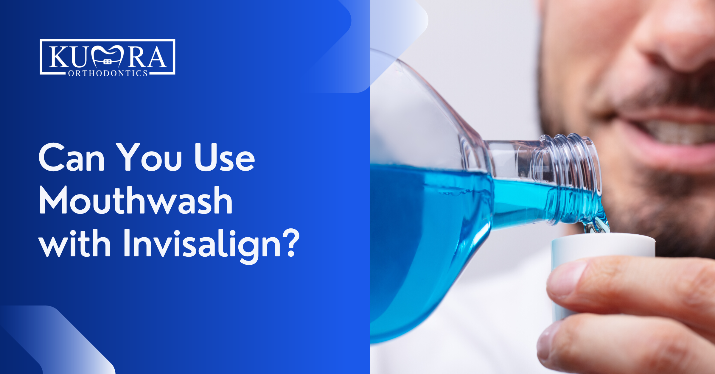 Using Mouthwash with Invisalign: Dos and Don’ts