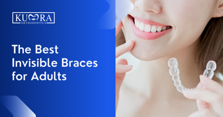 The Best Invisible Braces for Adults