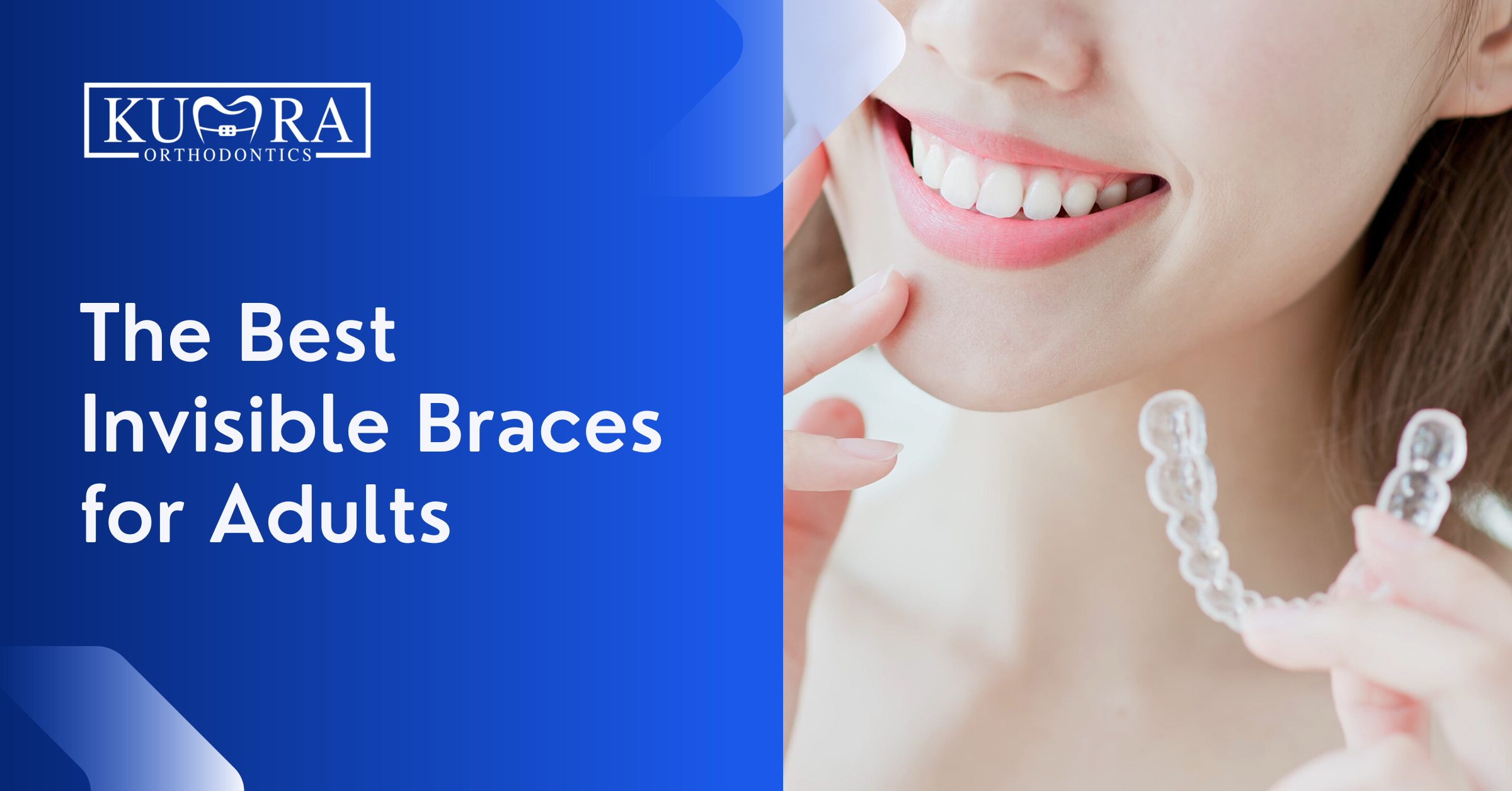 Invisible Braces: The Most Popular Way to Straighten Teeth