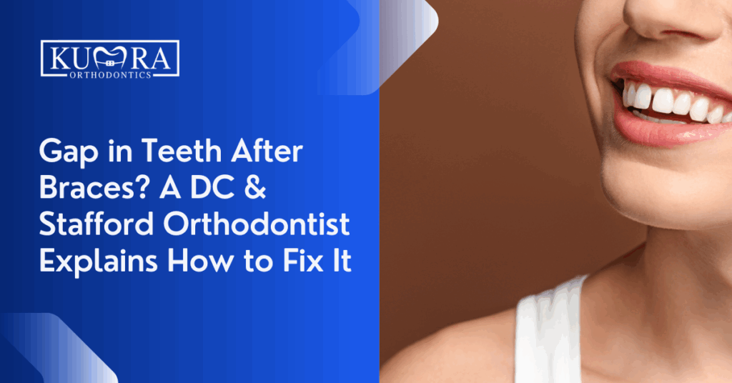 Gap in Teeth After Braces? A DC & Stafford Orthodontist Explains How to Fix It