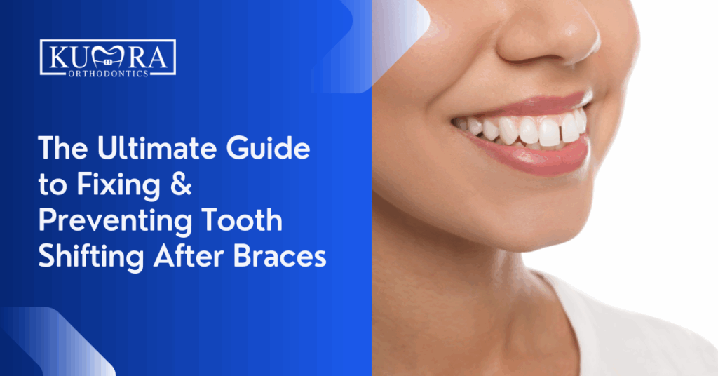 The Ultimate Guide to Fixing & Preventing Tooth Shifting After Braces
