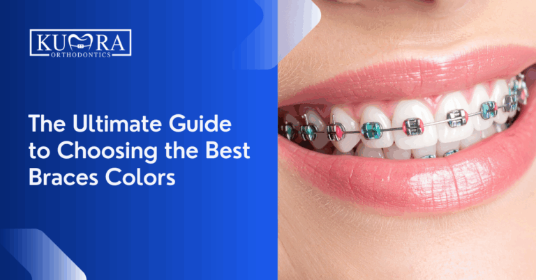 The Ultimate Guide to Choosing the Best Braces Colors