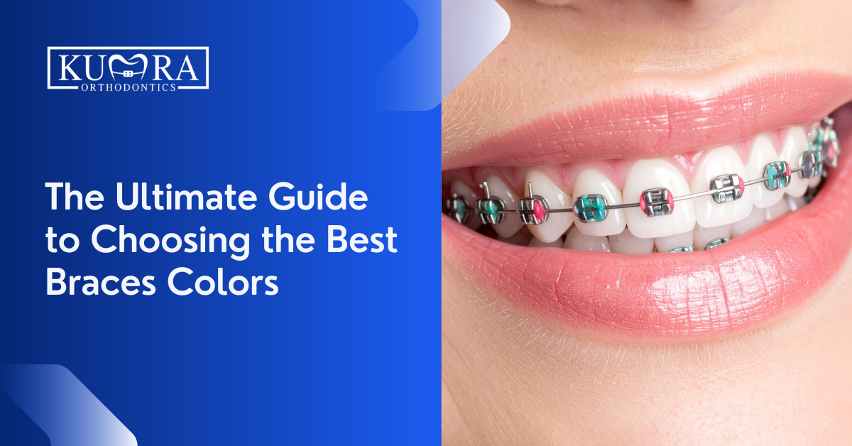 The Ultimate Guide to Choosing the Best Braces Colors